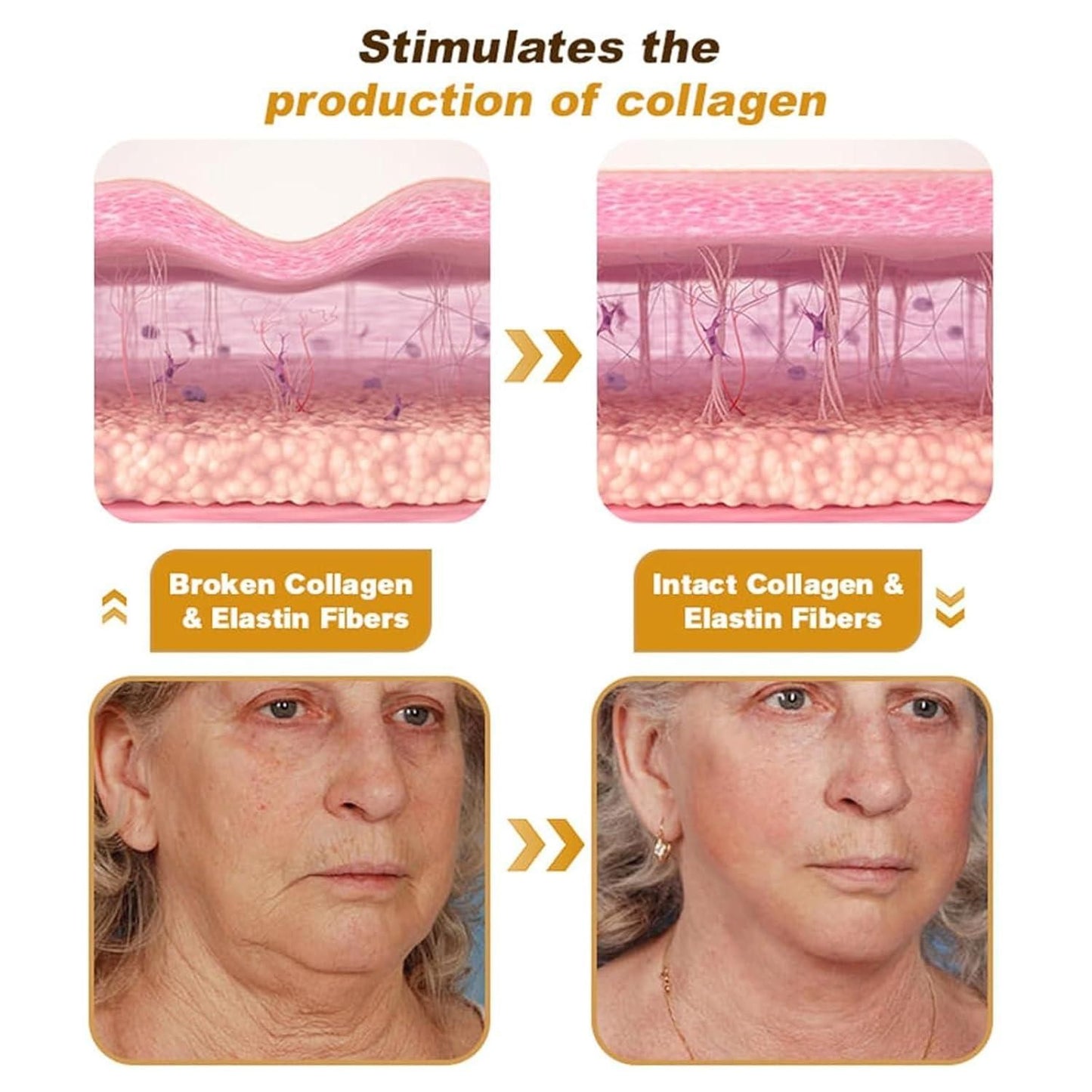 Botox Bee Venom Cream 20g Buy 1 Get 1 Free